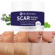 MURASAKI Scar Removal Cream, Scar Treatment - Stretch Marks Remover Cream for All Skin Types, New and Old Scar - 1 oz. / 30g